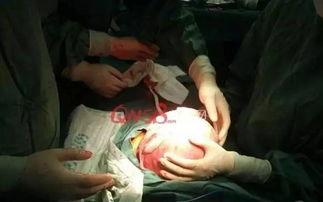 切掉子宫的明星有哪些,揭秘切子宫的明星背后故事